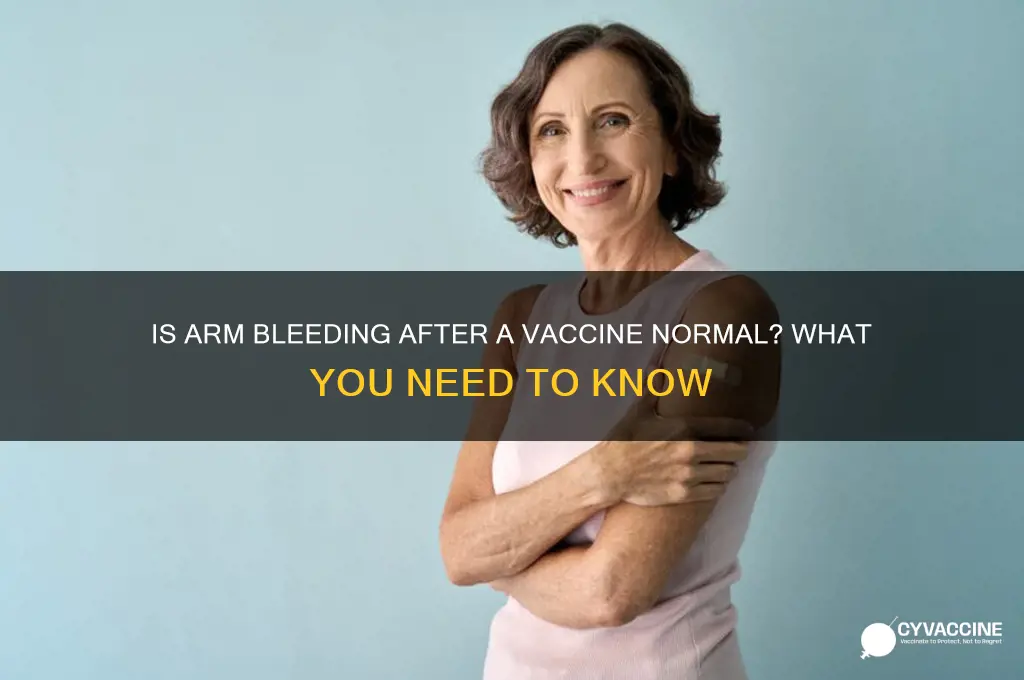 is it normal for arm to bleed after vaccine
