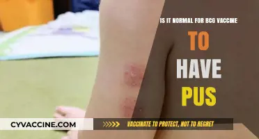 BCG Vaccine Pus: Normal Reaction or Cause for Concern?