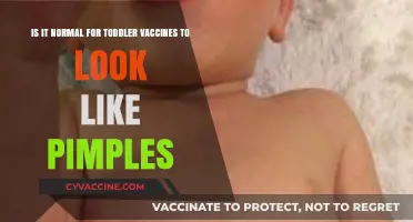 Toddler Vaccines and Skin Reactions: Are Pimple-Like Bumps Normal?