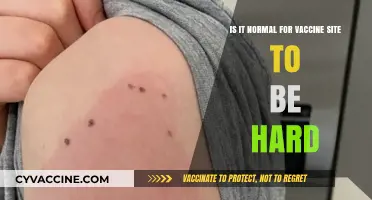 Is a Hard Lump at the Vaccine Site Normal?
