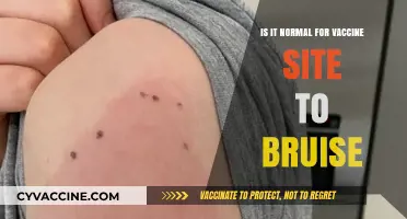 Is Vaccine Site Bruising Normal? Understanding Post-Shot Discoloration