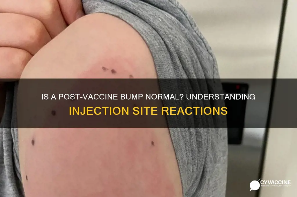 is it normal to have a bump after a vaccine