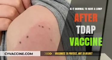 Is a Lump After Tdap Vaccine Normal? What to Expect