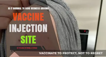 Redness Around Vaccine Injection Site: Normal or Cause for Concern?