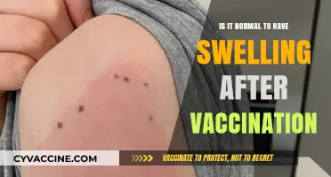 Is Post-Vaccination Swelling Normal? Understanding Common Side Effects