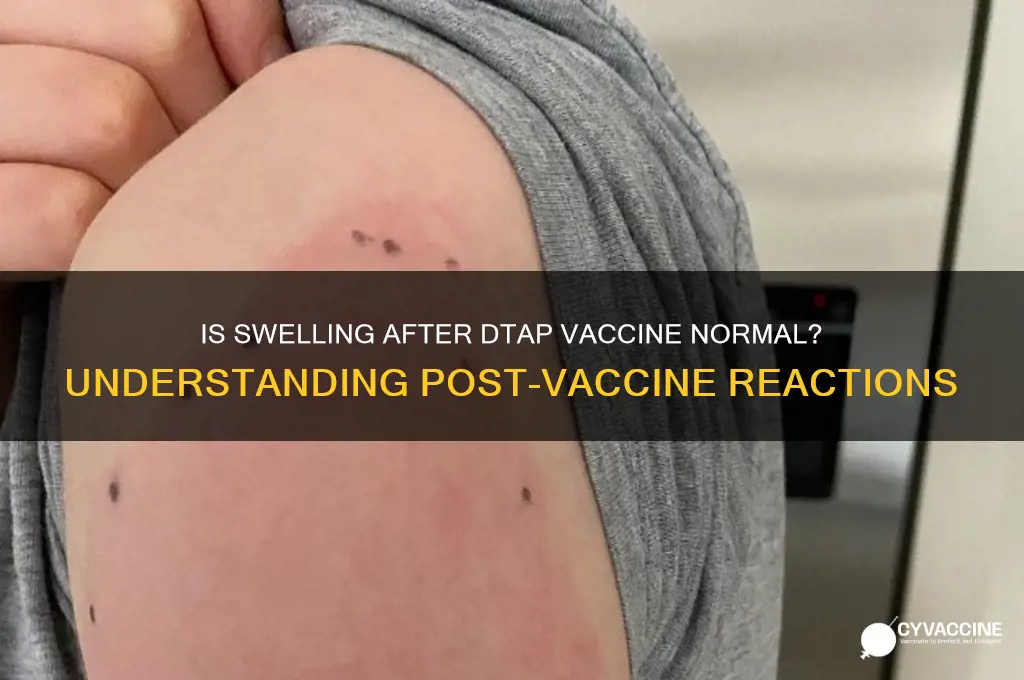 is it normal to have swelling days after dtap vaccine
