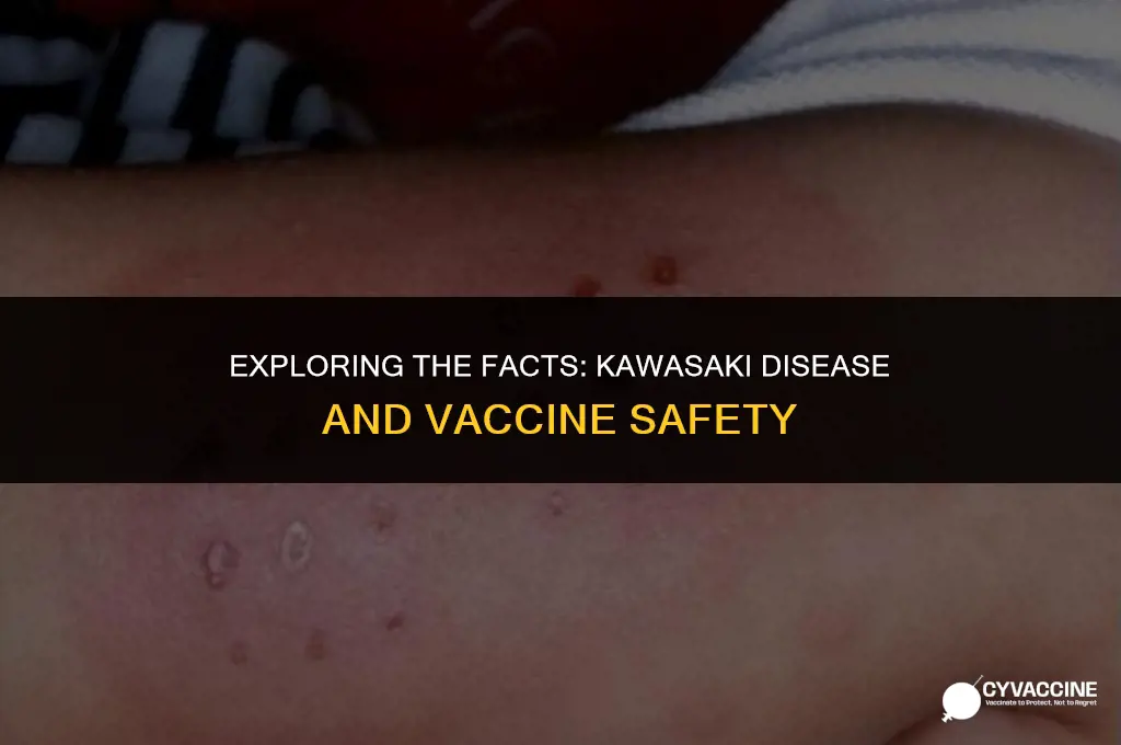 is kawasaki disease linked to vaccines