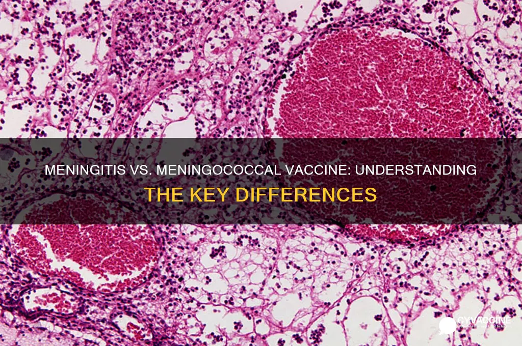 is menningitis vaccine the same as miningococcal vaccine