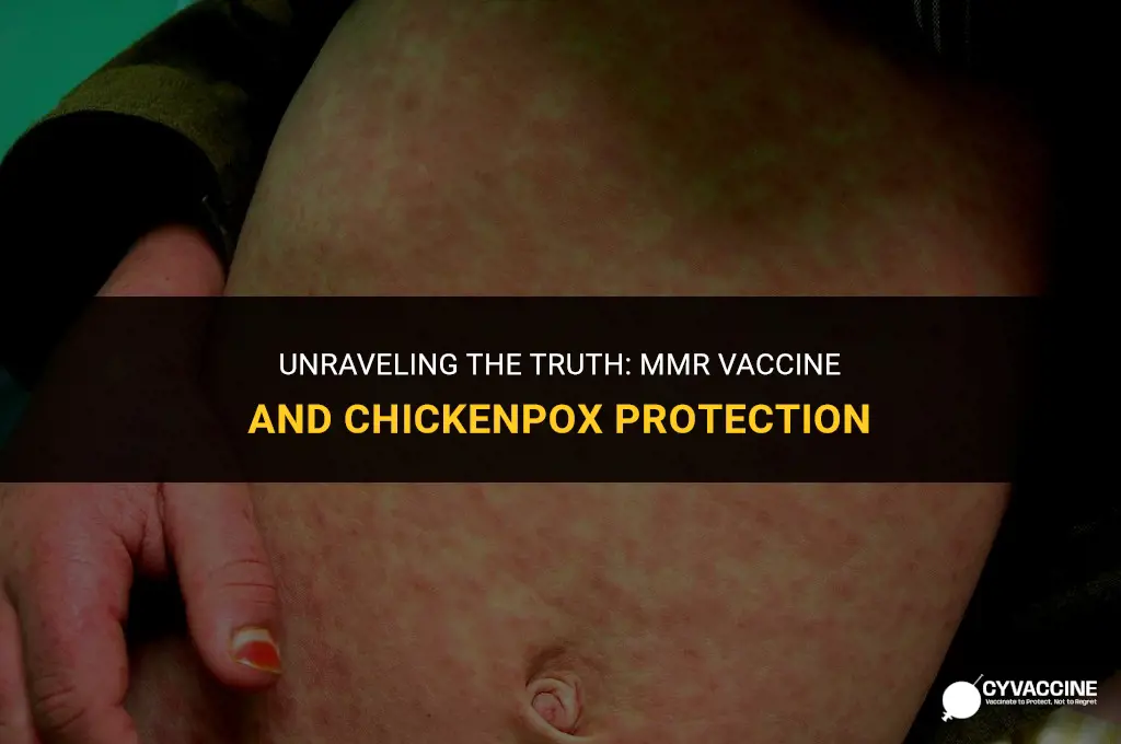 is mmr vaccine for chicken pox