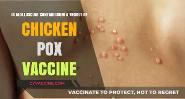 Is Molluscum Contagiosum Linked to the Chicken Pox Vaccine?