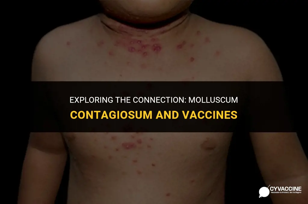is molluscum contagiosum related to vaccines