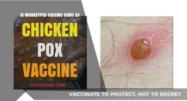 Monkeypox vs. Chickenpox: Are Their Vaccines the Same?