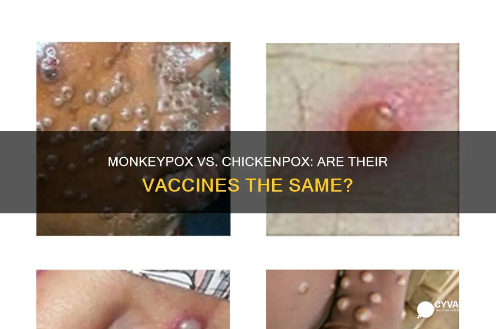 is monkeypox vaccine same as chicken pox vaccine