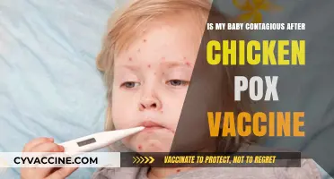 Can My Baby Spread Chickenpox After Vaccination? Key Facts for Parents