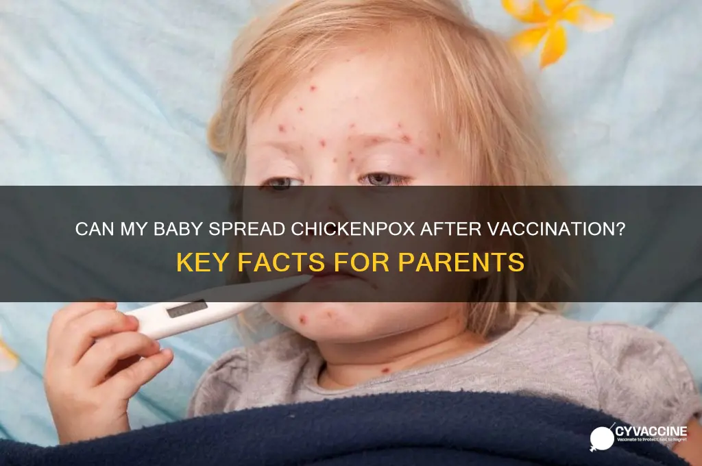 is my baby contagious after chicken pox vaccine