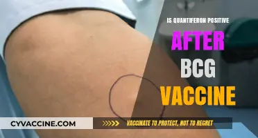 Understanding Quantiferon Results Post-BCG Vaccination: A Comprehensive Guide
