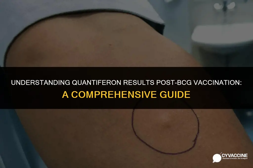 is quantiferon positive after bcg vaccine