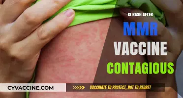 Understanding the Contagiousness of MMR Vaccine Rashes