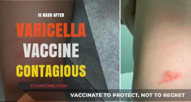 Understanding the Contagiousness of Rash After Varicella Vaccination