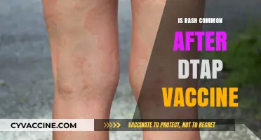 Understanding Common Side Effects: Rash After DTaP Vaccine