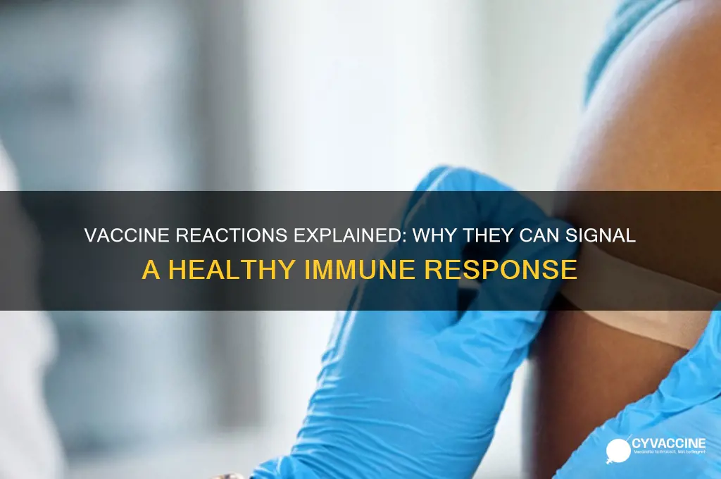 is reacting to a vaccine a good thing