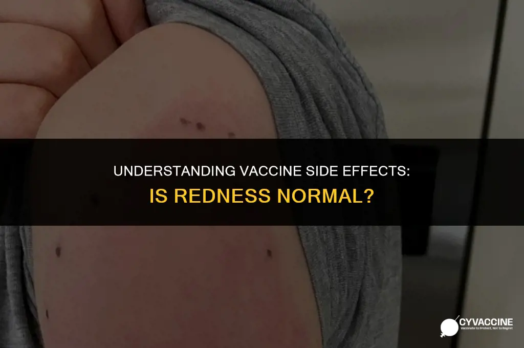 is redness after a vaccine normal
