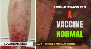 Is Redness at Vaccine Injection Site Normal? Expert Insights