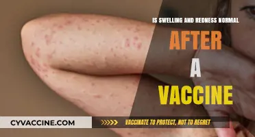 Is Swelling and Redness Normal After a Vaccine? What to Expect