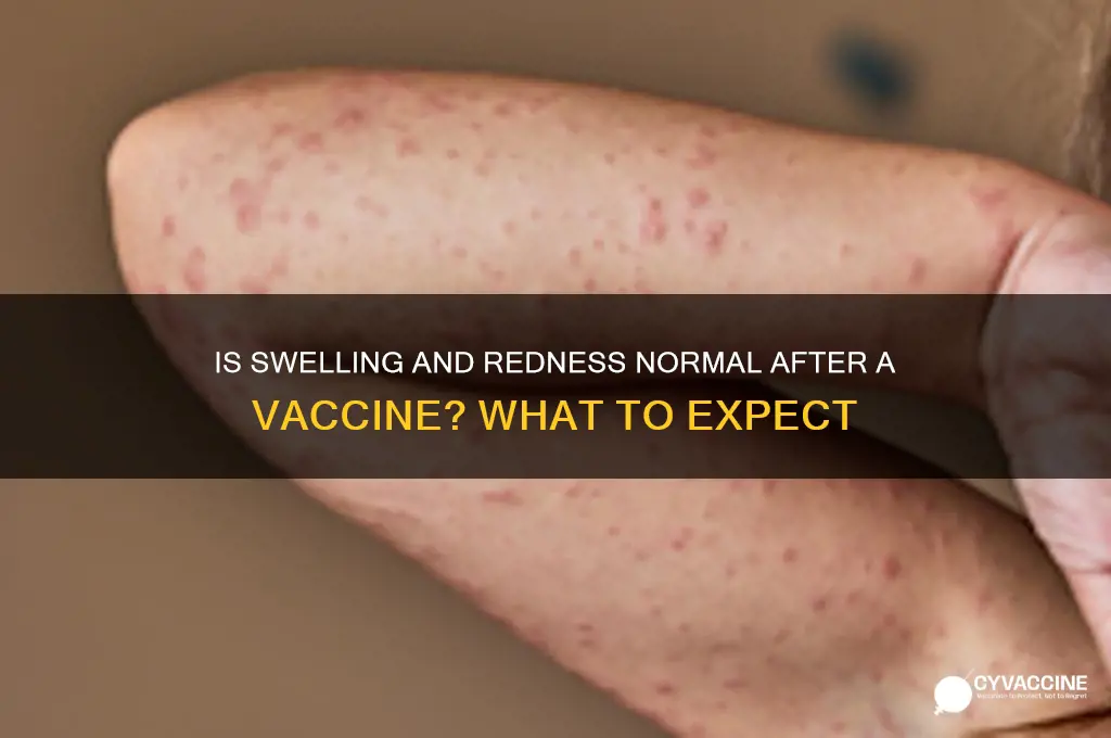 is swelling and redness normal after a vaccine