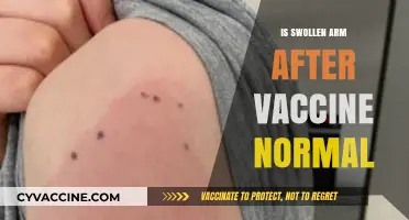 Understanding Post-Vaccine Side Effects: Is a Swollen Arm Normal?