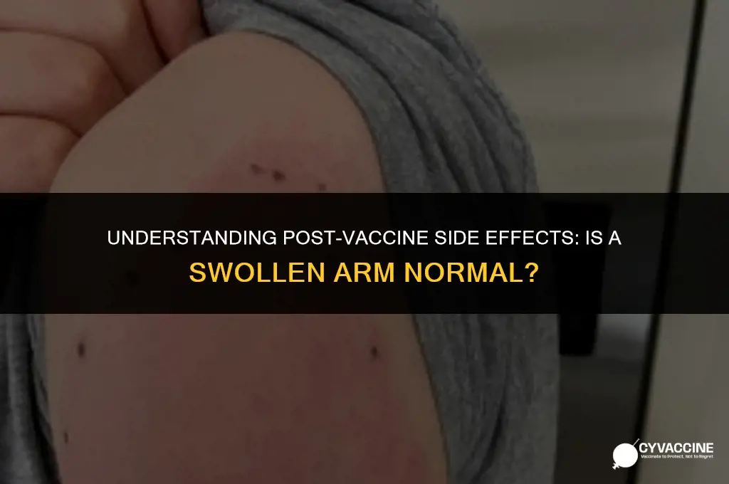 is swollen arm after vaccine normal