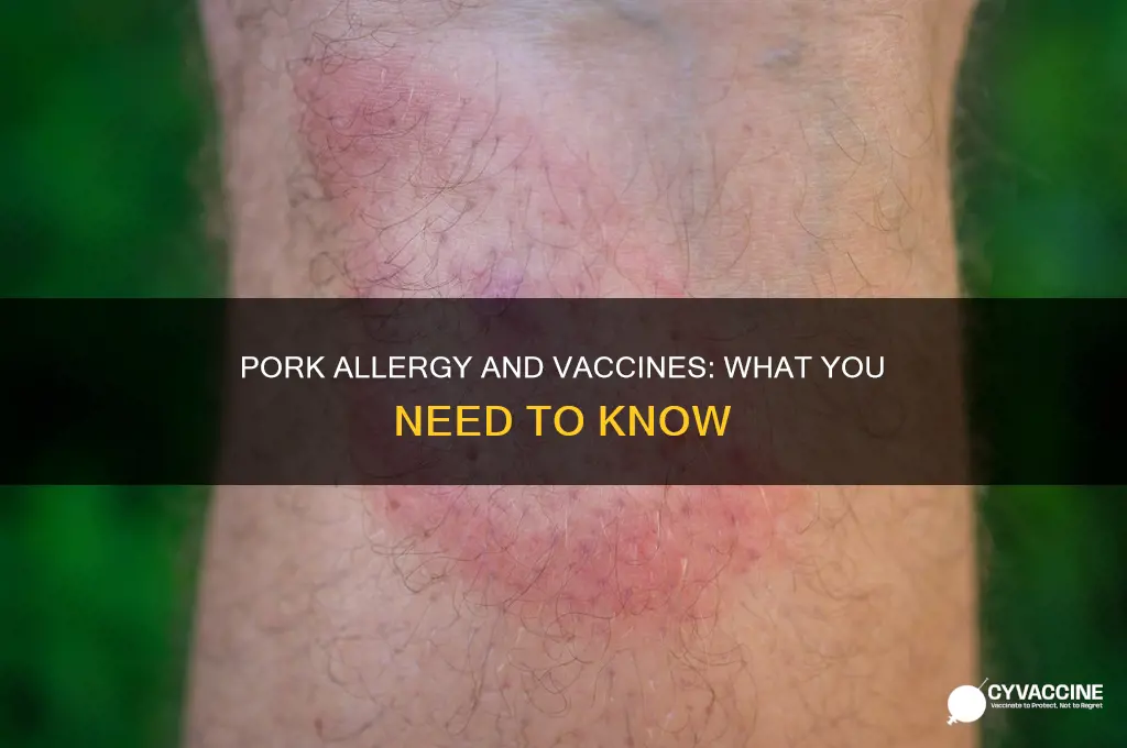 is taking vaccines not recommended if allergic to pork