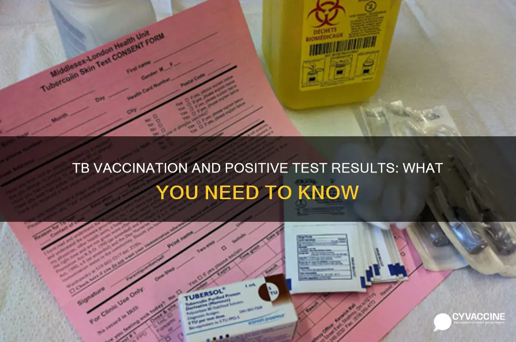 is tb is positive if we took vaccination