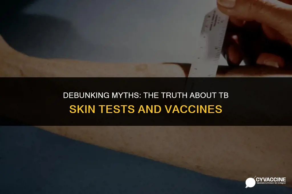 is tb skin test a vaccine