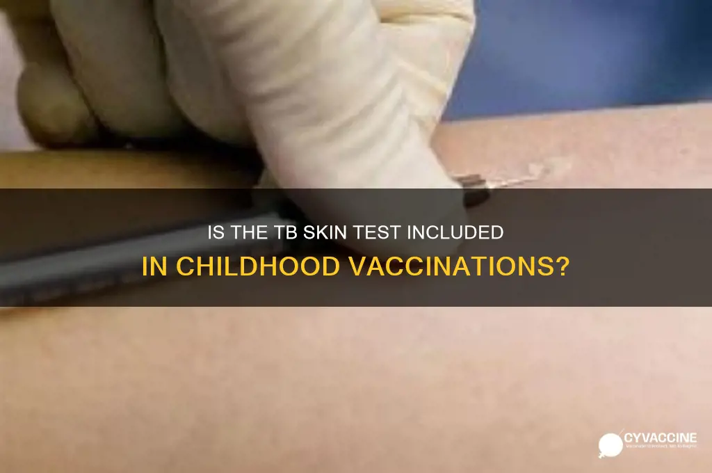 is tb skin test part of childhood vaccinations