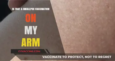 Is That a Smallpox Vaccination Scar on My Arm?