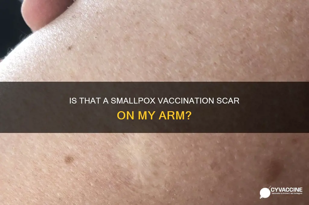 is that a smallpox vaccination on my arm