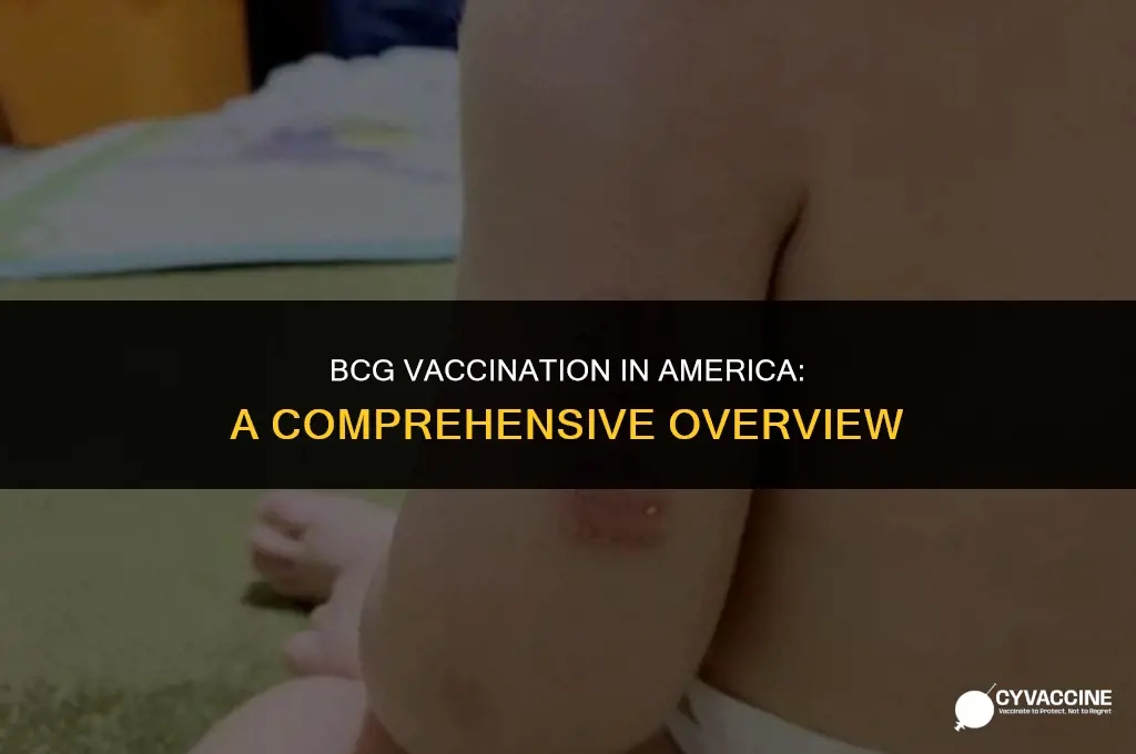 is the bcg vaccination in america