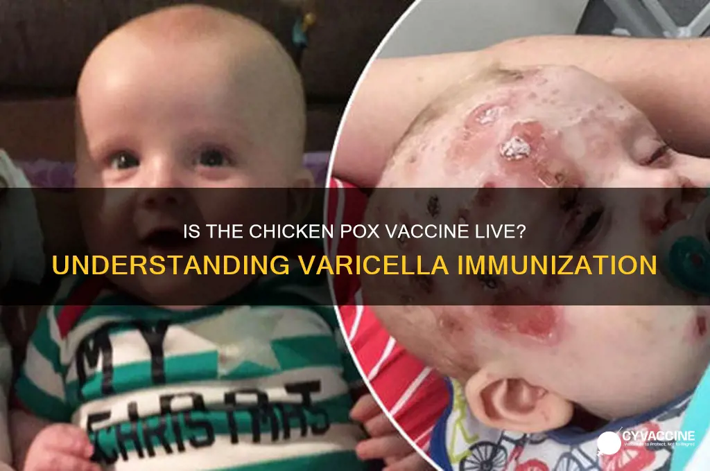is the chicken pox vaccine a live vaccine