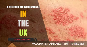 Chicken Pox Vaccine Availability in the UK: What You Need to Know