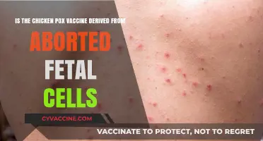 Chicken Pox Vaccine and Aborted Fetal Cells: Separating Fact from Fiction