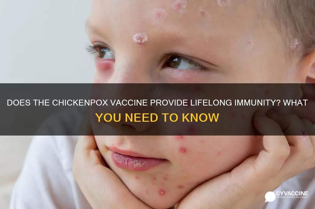 is the chicken pox vaccine for your entire life