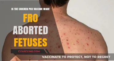 Chicken Pox Vaccine and Aborted Fetal Cells: Separating Fact from Fiction