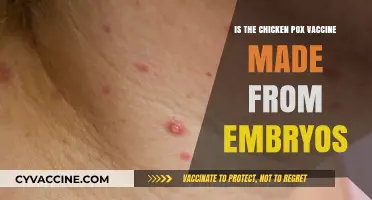 Chicken Pox Vaccine: Embryo-Derived or Not? Unraveling the Truth