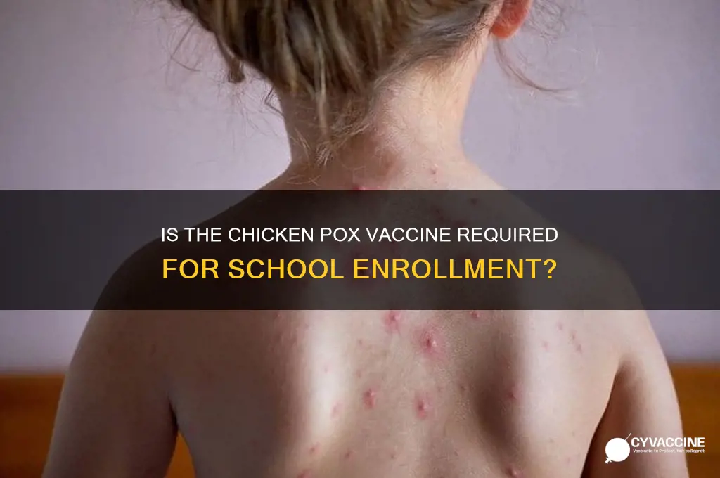 is the chicken pox vaccine mandatory for school