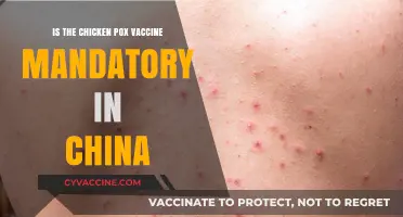 Is the Chicken Pox Vaccine Mandatory in China? Key Insights