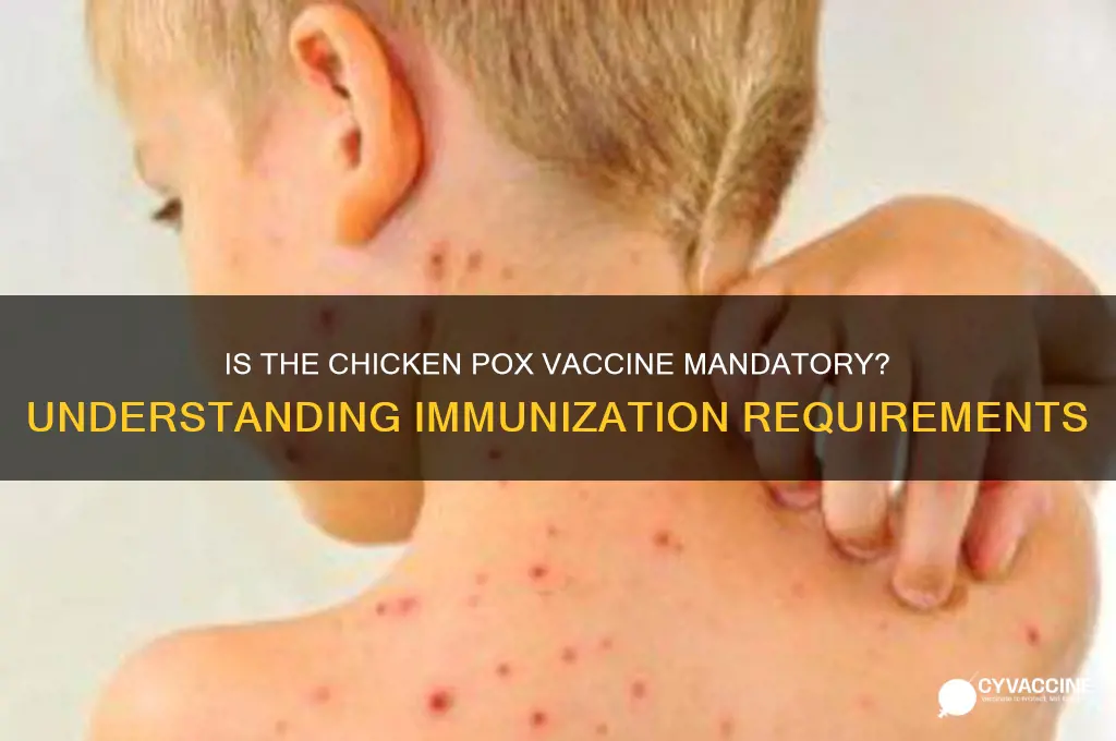 is the chicken pox vaccine mandatory