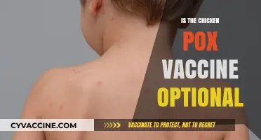 Exploring the Chicken Pox Vaccine: Optional or Essential?