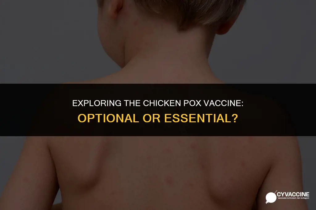 is the chicken pox vaccine optional
