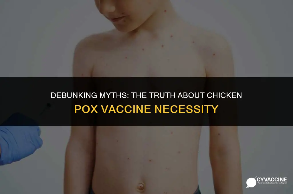 is the chicken poz vaccine necessary